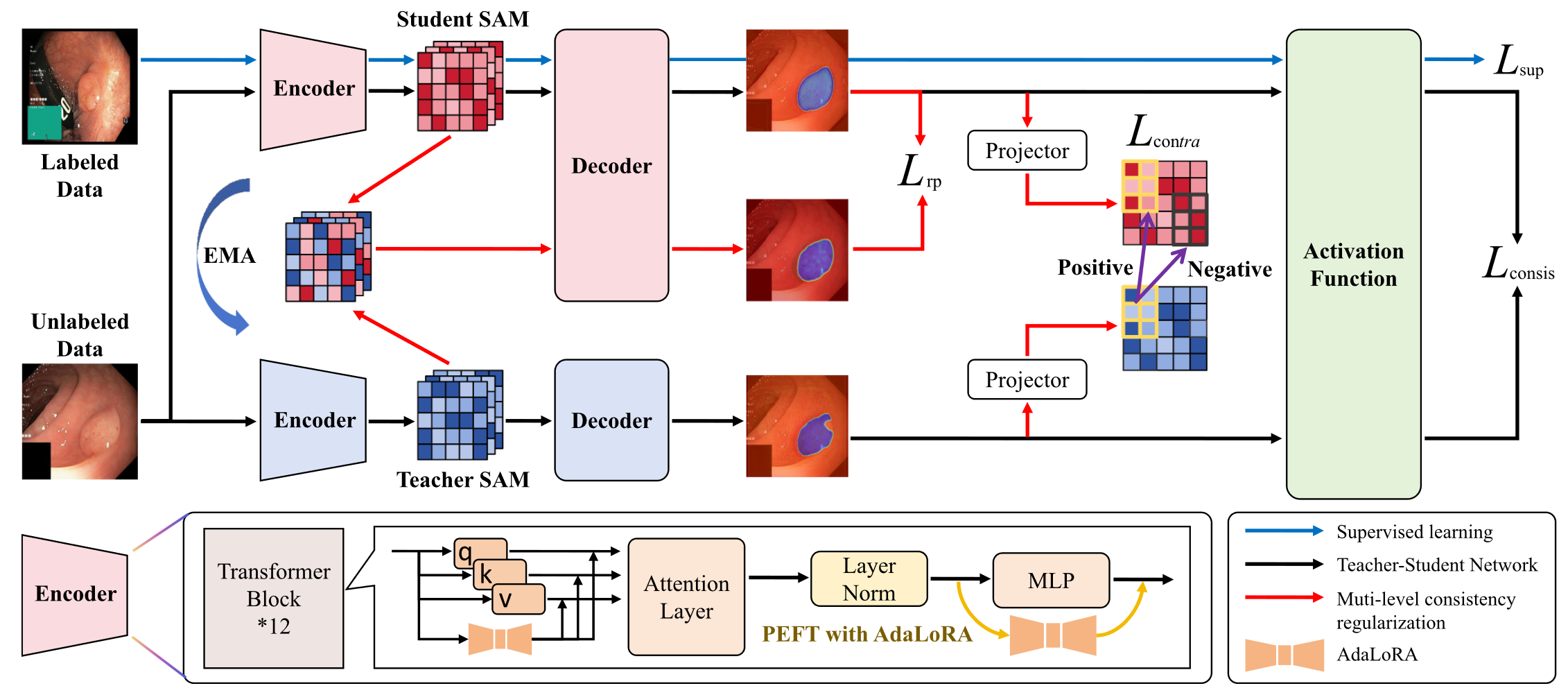 STAR: Empowering Semi-Supervised Medical Image Segmentation with SAM-based Teacher-Student Architecture and Contrastive Consistency Regularization